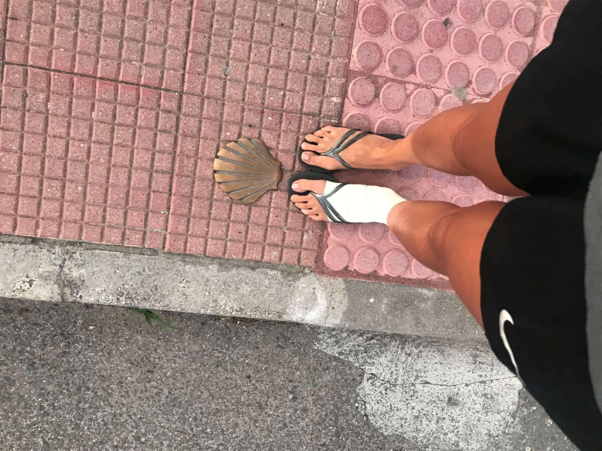 朝聖路上腳扭傷